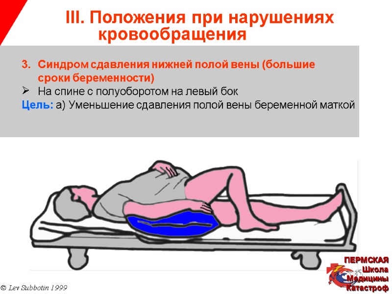 III. Положения при нарушениях   кровообращения © Lev Subbotin 1999